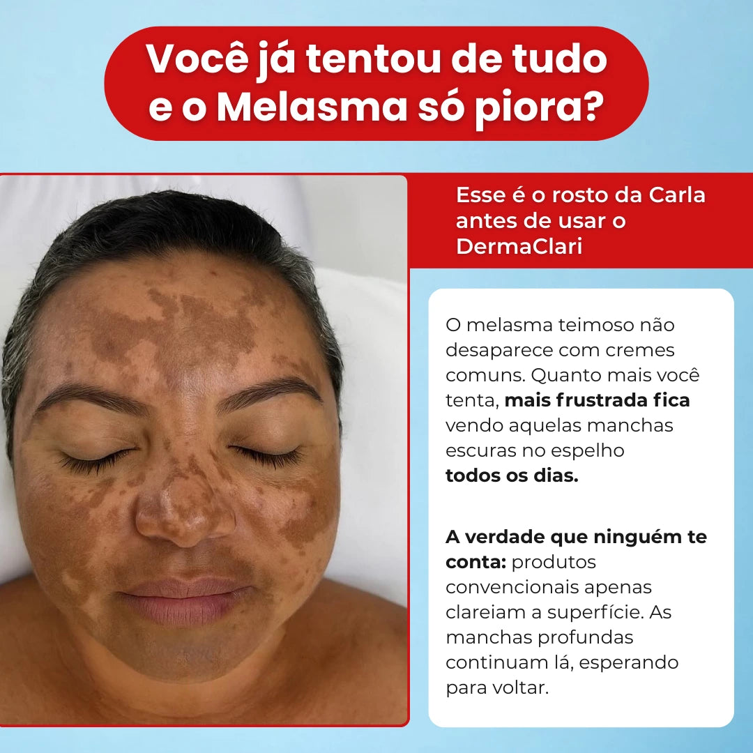 DermaClari | A evolução do clareamento facial